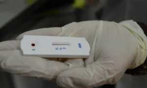 Saúde orienta farmácias sobre testes para HIV,…